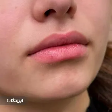 کلینیک زیبایی رز