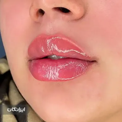 کلینیک زیبایی لیانا