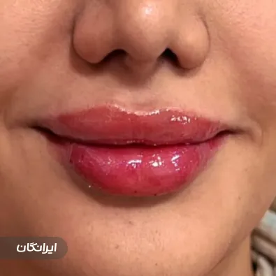 کلینیک زیبایی دکتر آتوسا معماریان