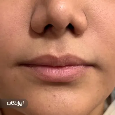 کلینیک زیبایی دکتر آتوسا معماریان