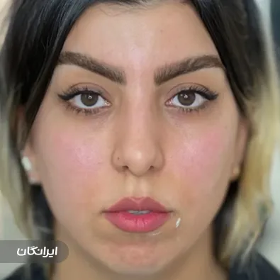 کلینیک زیبایی دکتر ملیکا حیاتی