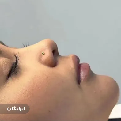 کلینیک زیبایی دیانا