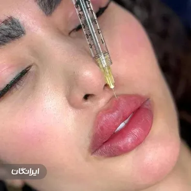 کلینیک زیبایی مهرو