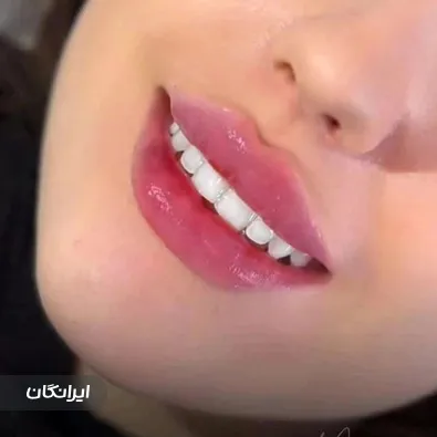 کلینیک زیبایی مهرو