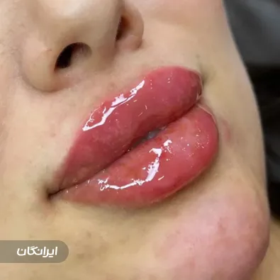 کلینیک زیبایی آوا