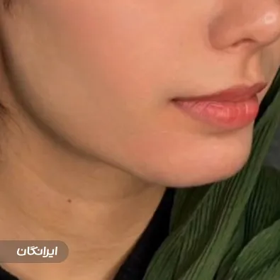 کلینیک زیبایی آوا