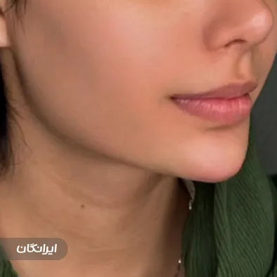 کلینیک زیبایی آوا