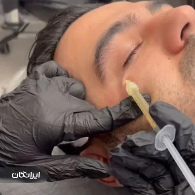 کلینیک زیبایی نوشیو