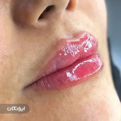 کلینیک زیبایی دکتر مهران نیک اقبال