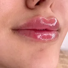 کلینیک زیبایی آدونیس