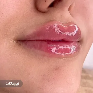 کلینیک زیبایی آدونیس