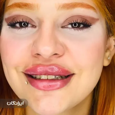 کلینیک زیبایی درویش