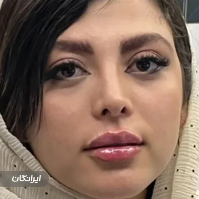 کلینیک زیبایی آویسا