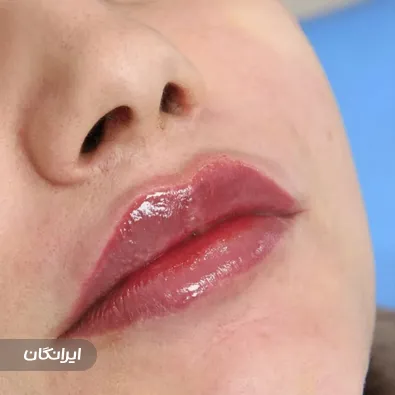 دکتر مسعود کرایی