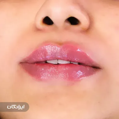 دکتر مسعود کرایی