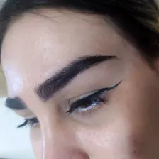 مرکز کاشت مو شیما