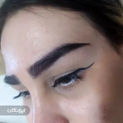 مرکز کاشت مو شیما