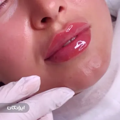 کلینیک زیبایی دکتر لیلا گزین