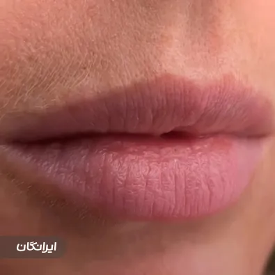 کلینیک زیبایی دکتر لیلا گزین