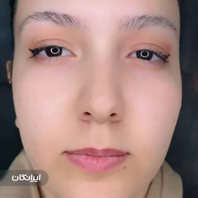 کلینیک زیبایی آذین کاشت