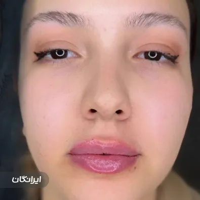 کلینیک زیبایی آذین کاشت