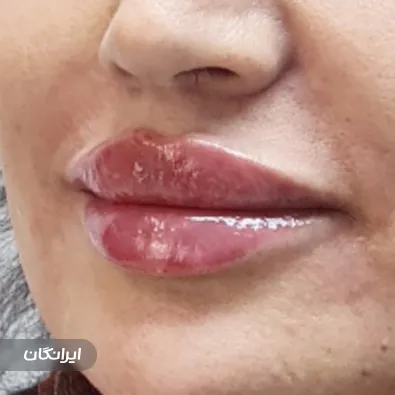 کلینیک زیبایی دکتر زهرا نعمت اللهی