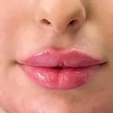 کلینیک زیبایی دکتر زهرا نعمت اللهی