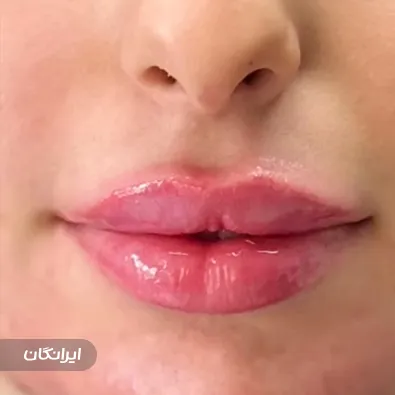 کلینیک زیبایی دکتر زهرا نعمت اللهی