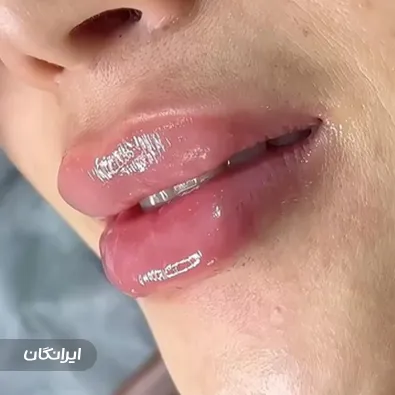 کلینیک زیبایی آتریا