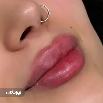 کلینیک زیبایی فیس بیوتی