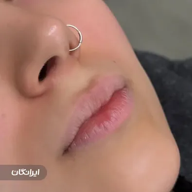 کلینیک زیبایی فیس بیوتی