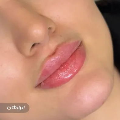 کلینیک زیبایی فیس بیوتی