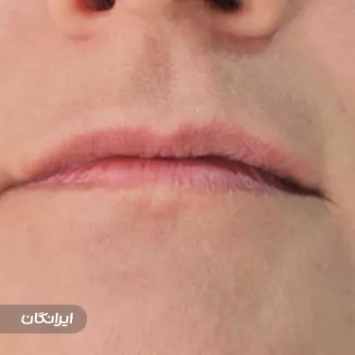 کلینیک زیبایی گلاریس