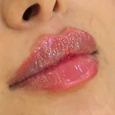 کلینیک زیبایی گلاریس