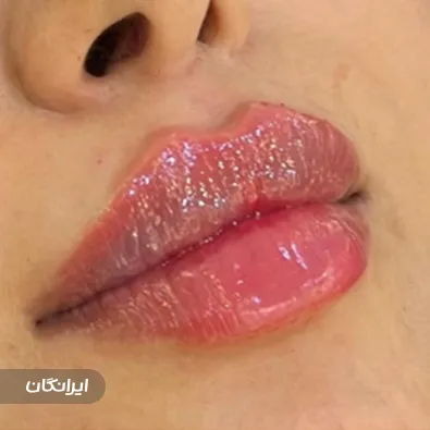 کلینیک زیبایی گلاریس