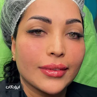 کلینیک زیبایی آیسان