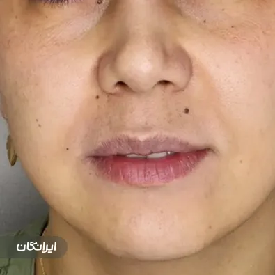 کلینیک زیبایی دکتر رامین راه انجام