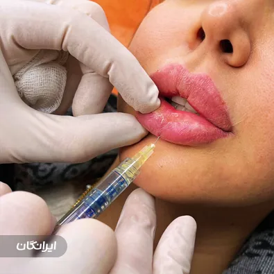 کلینیک زیبایی دکتر رامین راه انجام