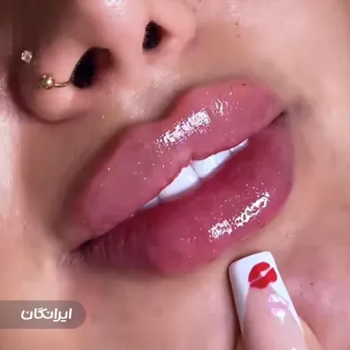 کلینیک زیبایی میترا