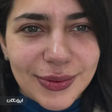 کلینیک زیبایی دکتر فاطمه تذروی