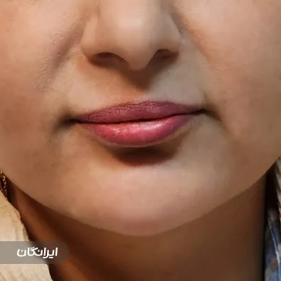 کلینیک زیبایی نهال