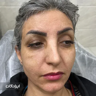 کلینیک زیبایی پارسیما