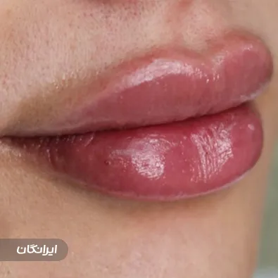 خانه لیزر و زیبایی تبریز