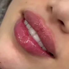 خانه لیزر و زیبایی تبریز