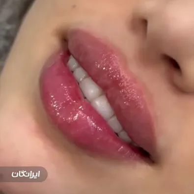 خانه لیزر و زیبایی تبریز