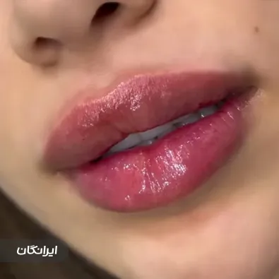 خانه لیزر و زیبایی تبریز