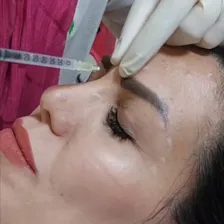 کلینیک زیبایی ایپک