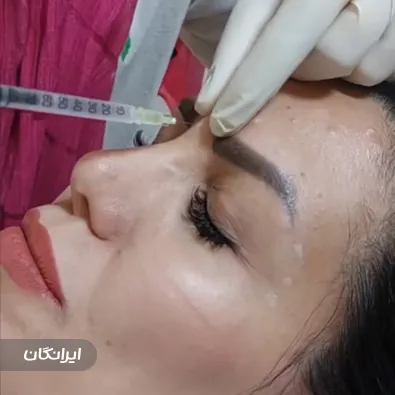 کلینیک زیبایی ایپک