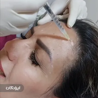 کلینیک زیبایی ایپک