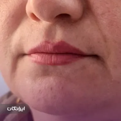 کلینیک زیبایی ایپک